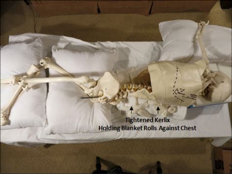 Image result for Left Thoracotomy