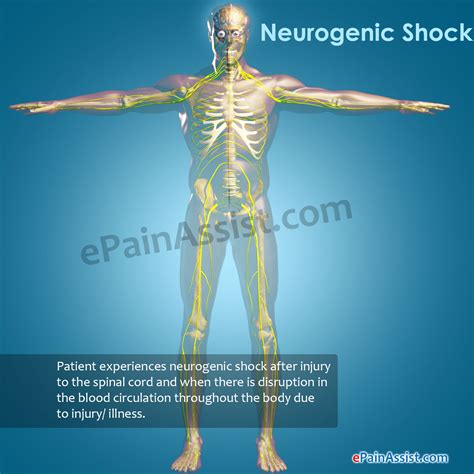 Neurogenic Shock|Causes|Signs|Symptoms|Treatment|Diagnosis