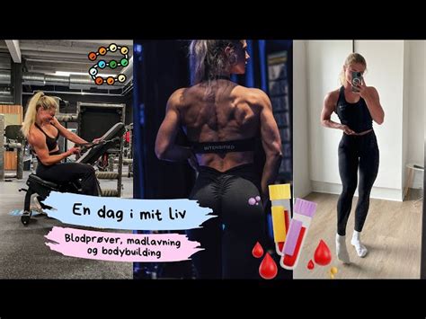 The A1C Test Explained: What It Means for Your Diabetes Management