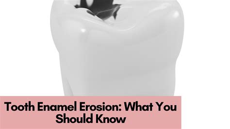 Baby Teeth Enamel Erosion at Lewis Bonnett blog