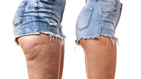 Exercises To Reduce Thigh Fat And Hips In Hindi (जांघों को पतला करने के ...