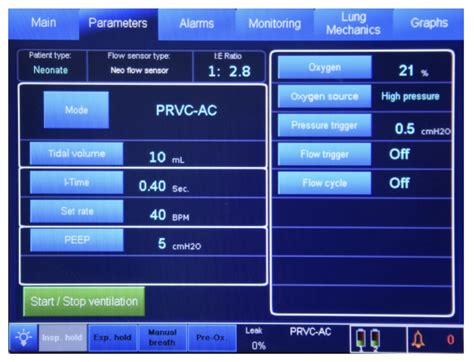 TV-100 Ventilator - Breathing & Medical