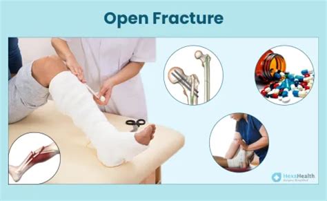 Image result for Open Fracture Surgery