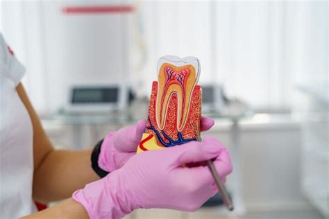 Root Canal Aftercare: 5 Effective Tips for a Speedy Recovery