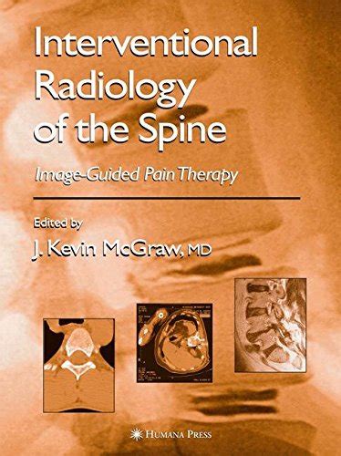 Interventional Radiology of the Spine: Image-Guided Pain Therapy eBook ...