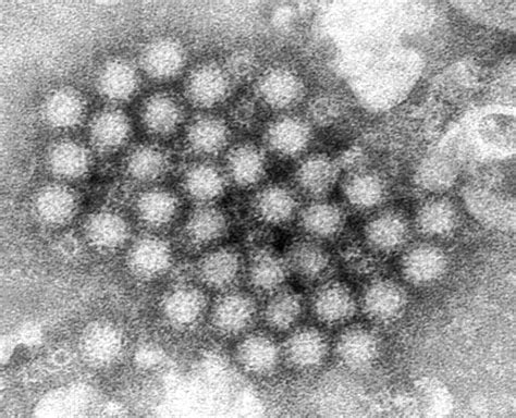Norovirus illnesses are up in some places. Here's what you need to know | The Independent