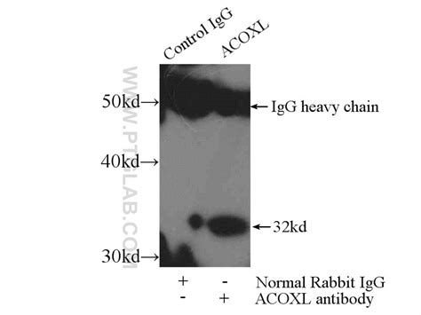 ACOXL antibody (23366-1-AP) | Proteintech