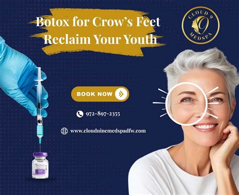 Botox for Crow’s Feet in Fort Worth, TX | Reclaim Your Youth