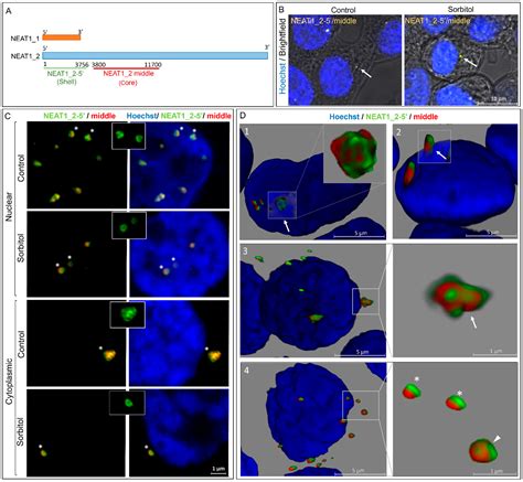Dynamic Localization of Paraspeckle Components under Osmotic Stress
