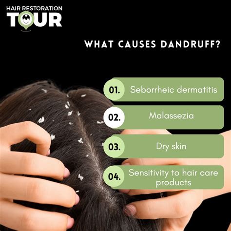 Does Dandruff Cause Hair Loss? | Not Directly, But It Could.