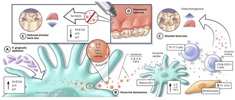 The Role of Cellular Senescence in Oral Health and Disease