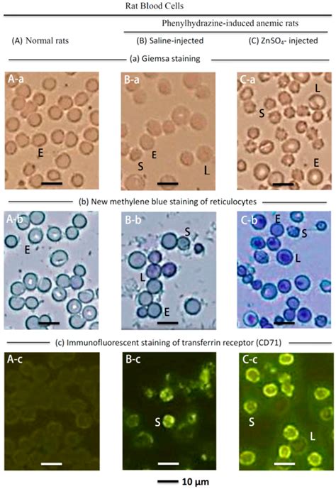 Zinc Supplementation Stimulates Red Blood Cell Formation in Rats