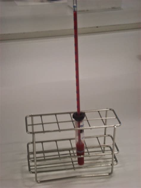 CUADERNO DE PRÁCTICAS HEMATOLOGÍA: Práctica: Determinación de la velocidad de sedimentación ...