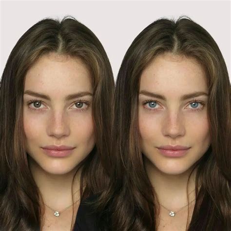 Image result for Eye Color Surgery