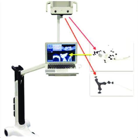 Image result for Optical Tracking System