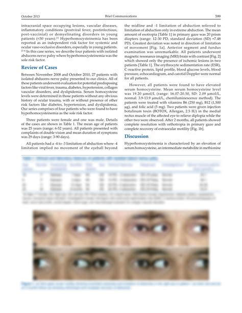 SOLUTION: Isolated abducens nerve palsy with hyperhomocysteinemia ...