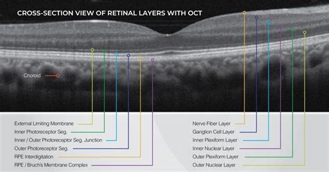 Image result for How to Use the Oct Scan in Optometry