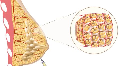 Image result for Linear Grogramming Problem Brain Map
