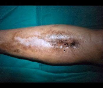 Best Bone Specialist in Bangalore | Top Bone Treatment Specialist in ...