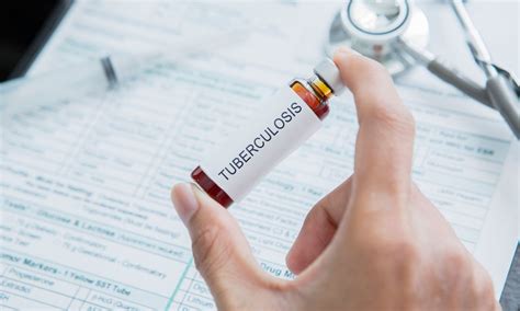 India Records 21% Drop in TB Cases, Still Accounts for 25% of Global ...