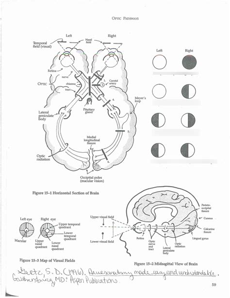 Image result for Visual Deficit Chart