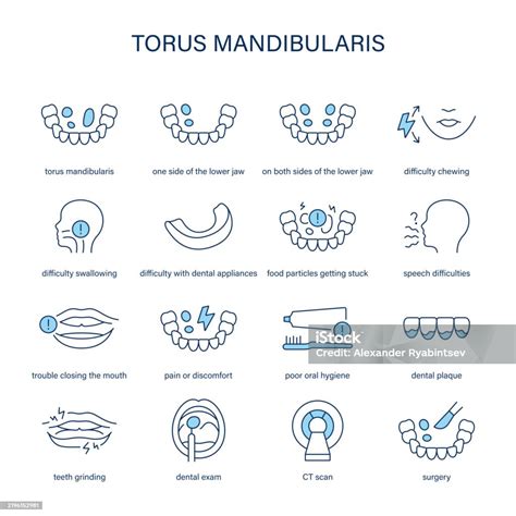 Torus Mandibularis Symptoms Diagnostic And Treatment Vector Icon Set Stock Illustration ...