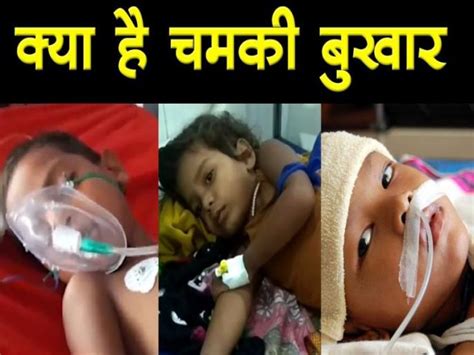 Chamki Bukhar Lakshan, chamki bukhar karan or Acute, Encephalitis ...