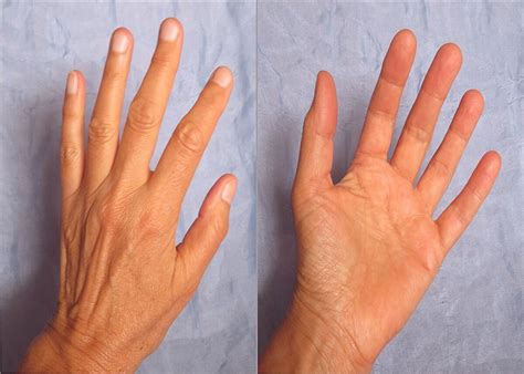 there such line in palm then there no problem of money in life one ...