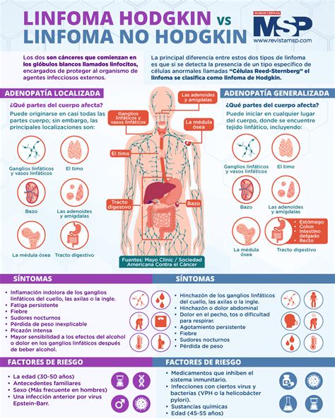 Cancer Linfatico Sintomas Linfoma No Hodgkin Centrofacial Relacionado