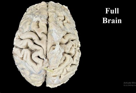 Full Brain | NAMO Medical Education & Research Institute