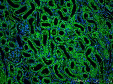 RAPGEF2 antibody (31299-1-AP) | Proteintech