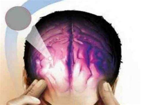 चमकी बुखार के लक्षण (Symptoms of Acute Encephalitis Syndrome)