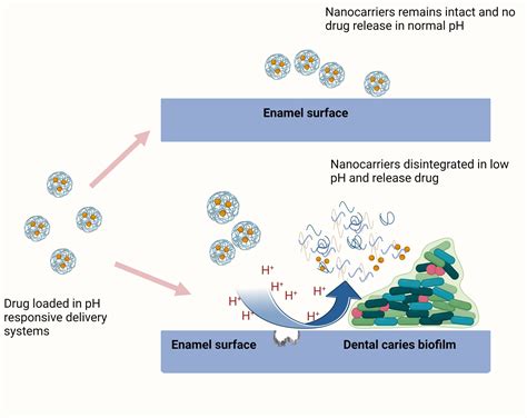 pH-Responsive Biomaterials for the Treatment of Dental Caries—A ...