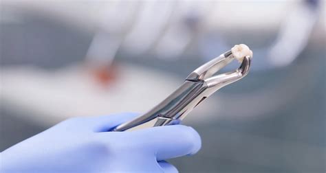 Image result for Healing Process of Tooth Extraction