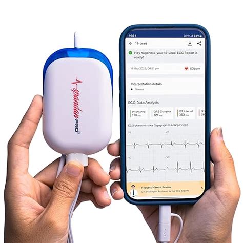 Sunfox Spandan Pro | Portable ECG Machine | Medical Grade 12 Lead ECG ...