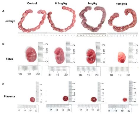 Inhibitory Impact of Prenatal Exposure to Nano-Polystyrene Particles on ...
