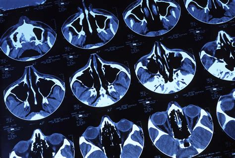 Image result for Rad Cat Scan