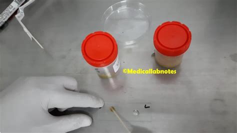 Image result for Fit Stool Test