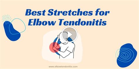 Image result for Extensor Tendonitis Stretches