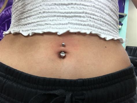 Belly Button Piercing With Keloid at Charli Bayly blog