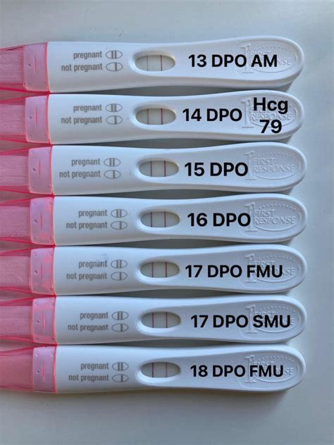 FRER progression 13 - 18 DPO with one slightly lighter test, dye ...