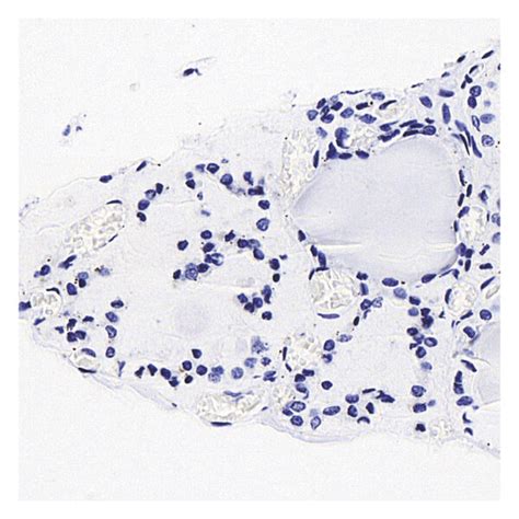 Image result for IHC Staining