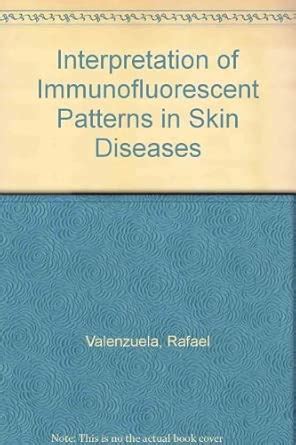 Buy Interpretation of Immunofluorescent Patterns in Skin Diseases Book ...