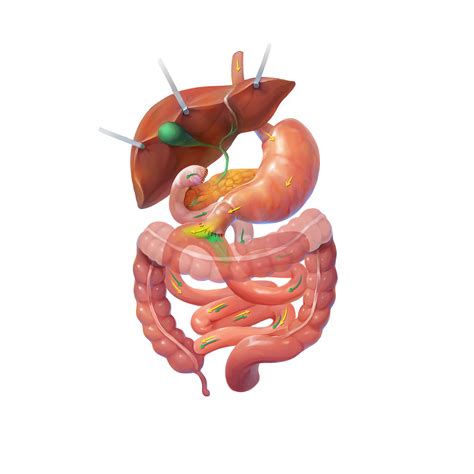 Single Anastomosis Duodeno-Ileal Bypass / SADI Bariatric Surgery