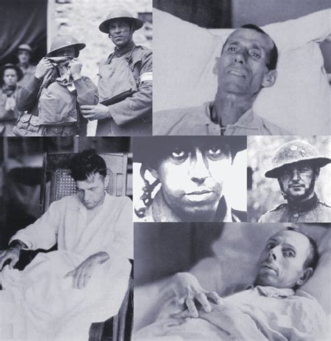 Image result for Shell Shock History