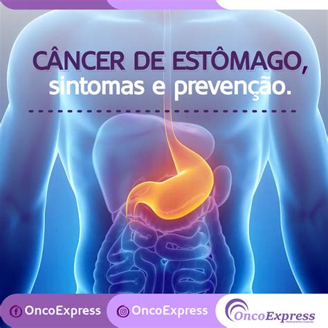 Câncer de estômago, sintomas e prevenção - OncoExpress