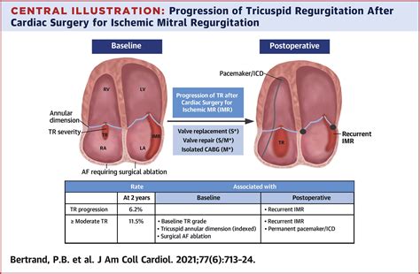 Progression of Tricuspid Regurgitation After Surgery for Ischemic Mitral Regurgitation | Journal ...