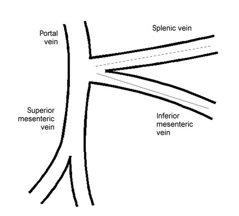 Inferior Mesenteric Vein