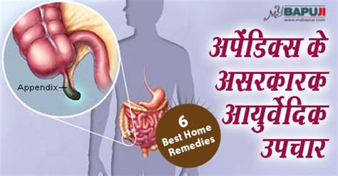 श्वेत प्रदर के रोग को जड़ से मिटा देंगे यह 33 घरेलू उपाय | Leucorrhoea