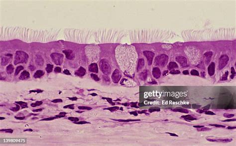 Image result for Visual Growing Patterns